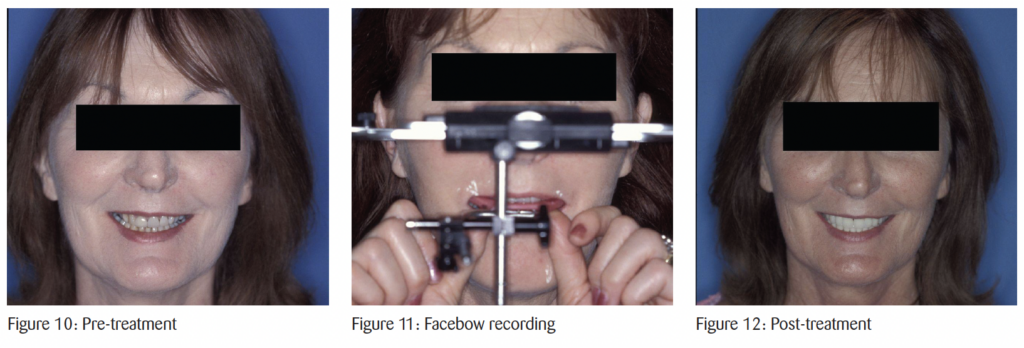 The timeless principles behind predictable full-mouth reconstruction