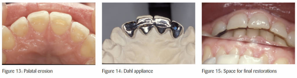 The timeless principles behind predictable full-mouth reconstruction