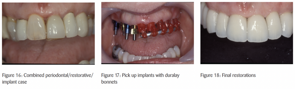 The timeless principles behind predictable full-mouth reconstruction
