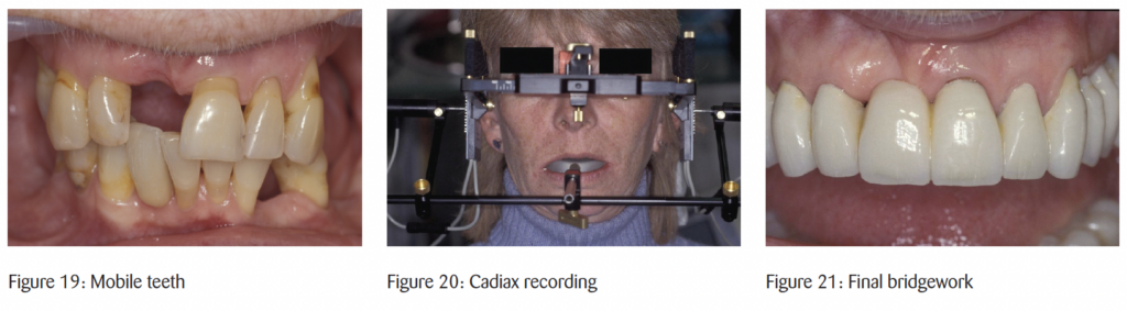 The timeless principles behind predictable full-mouth reconstruction